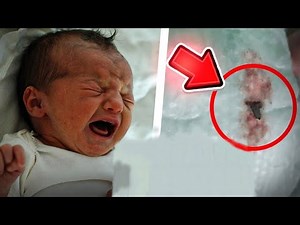 Baby couldn't stop screaming when mom check Diaper she find out the shock of her life