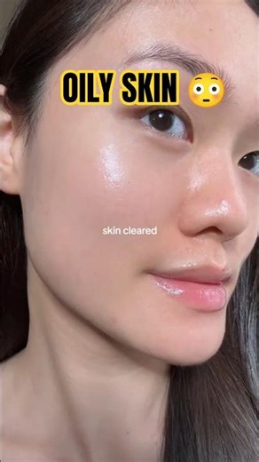 Best Moisturizer for Oily Skin 💚 No More Greasy Face! #shorts #skincare