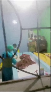 19yr old boy  falls into wood chipper. Just aftermath