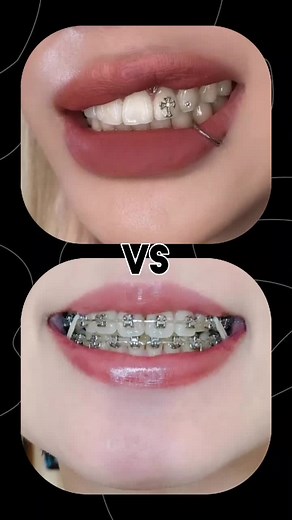 #19challanges #🖤🌃 #foryoupageofficialln #💜🖤🤍 #choseone #vschallenge #🦋🎵 #allchallenge #🌸💗🎀