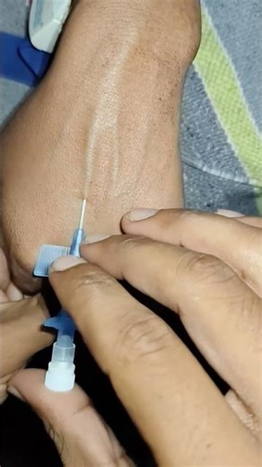 IV Cannula Insertion: Step-by-Step Guide for Beginners”