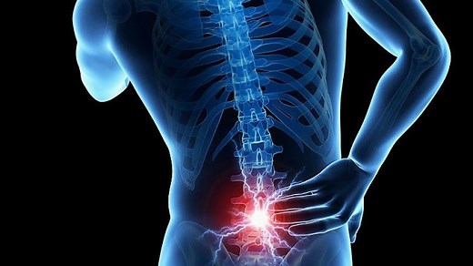 Back Soreness After Deadlifts...Is It Normal?