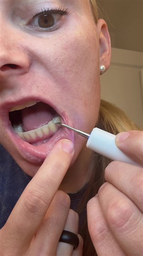 The best way to remove plaque and tartar from your teeth without the hassle of scheduling a dentist appointment #electrictoothcleaner #plaque #tartarremoval #cleanteeth #teethcare