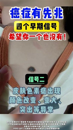 Top 4 Cancer Red Flags You Should Never Ignore