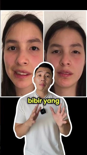HOW TO TREAT BELLS PALSY | BELLS PALSY MEDICINE #bellspalsy #youtubehealthindonesia #doctor