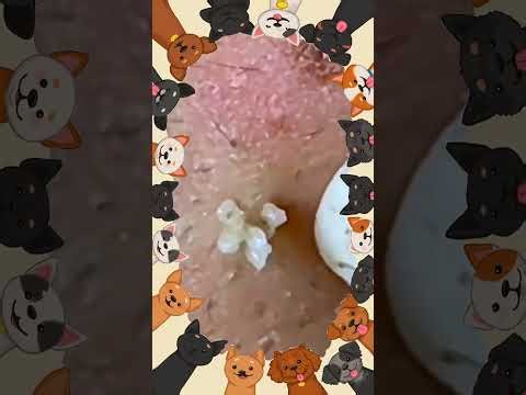 Satisfying Blackhead Removal | Acne Treatment, Pimple Pop & Deep Skin Clean-Up