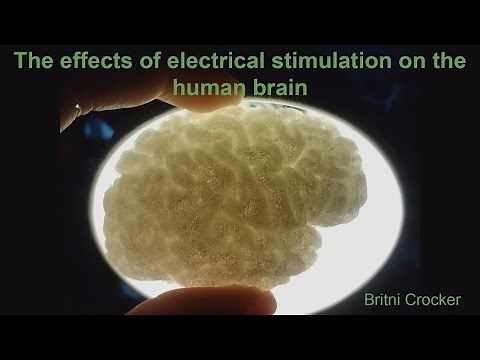 DOE CSGF 2016: The Effects of Electrical Stimulation on the Human Brain