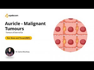 Tumours of External Ear | Auricle - Malignant Tumours