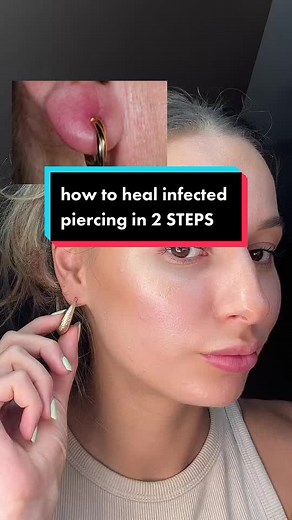 Infected Ear Piercing? Magic Salve to the Rescue! 💯