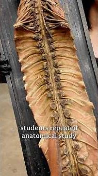 This Antique Anatomy Model Contains a Real Human Spine