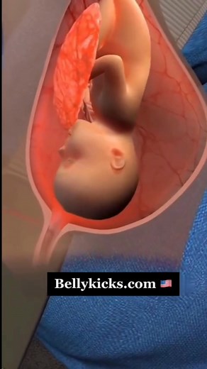 Are you pregnant?🤰🏼 Stay safe and comfortable on every ride! The Bellykicks is a smart seatbelt adjuster designed especially for moms-to-be. It gently redirects the seatbelt away from your belly, reducing pressure and giving you peace of mind while driving or riding in the car. ✔️ Easy to install & remove in seconds ✔️ Strong, durable, and universal fit ✔️ Makes every ride safer and more comfortable. Because your safety and your baby’s comes first. 💕 🎉 Get Yours Today — 60% OFF Free Shipping