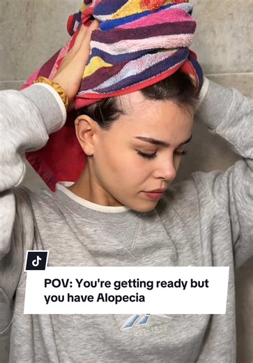 Getting Ready with Alopecia: Hair Tips and Tricks