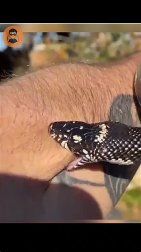 What should you do if a snake bites you? #shorts