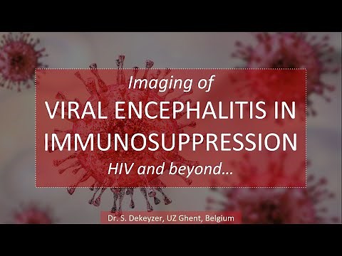 Imaging of viral Encephalitis (part 2): Viral Encephalitis in immunocompromised Patients (HIV...)