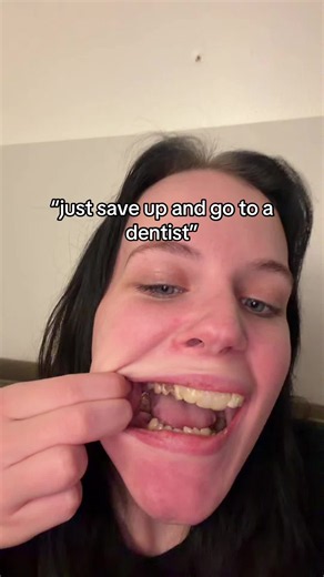 Dentist Visit & Saving for Teeth
