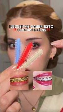NECESITAS saber esto de los brackets 😭‼️ #maquillaje #brackets #bracket #dientes #braces