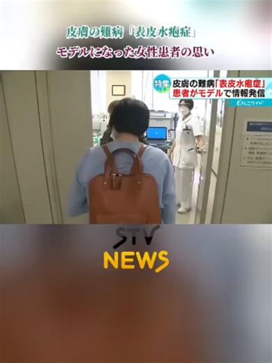 皮膚の難病「表皮水疱症」 多くの人に病気を知ってほしい…モデルになった女性患者の思い #TikTokでニュース