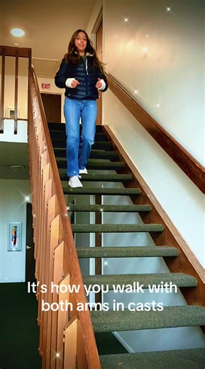 Irene's Inspiring Day with Both Arms in Casts