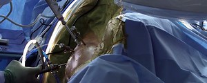 Diagnostic Hip Arthroscopy | Journal of Medical Insight