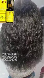 4.4K views · 31 reactions | #hairtnansformatio #feghairgrowspraybenefits #hairoilsforgrowthl #minoxdel #tnansformation #hairtnansformation #ዘይት #hairgol | እናት ኮስሞ | Facebook