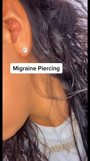 Effective Migraine Piercings for Relief