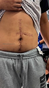 Win Win Win on Reels