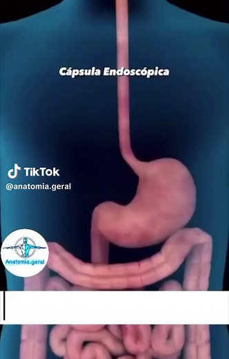 Cápsula Endoscópica: Tecnologia Avançada em Diagnóstico