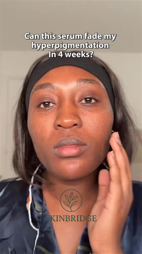 Skin Bridge 🌿🇿🇦 on Instagram: "Axis-Y serum for only R355 😮‍💨 ✔️ Free delivery ✔️ Bundle deals available From Skin Bridge #AxisY #SkinCareZA #SkincareDeals #GlowUpZA"