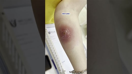 Creating Better Learning Experiences Through Video Guidance