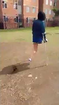 Beautiful Hip Amputee Crutching