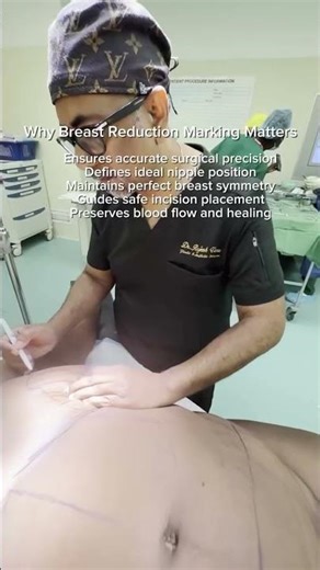 Every precise result begins with a well-planned marking.