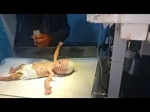 How to Bottle Feed a Baby | Step-by-Step Feeding Method for New Parents