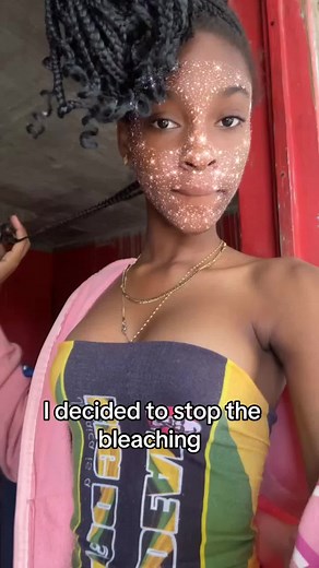 The Impact of Skin Bleaching in Jamaica