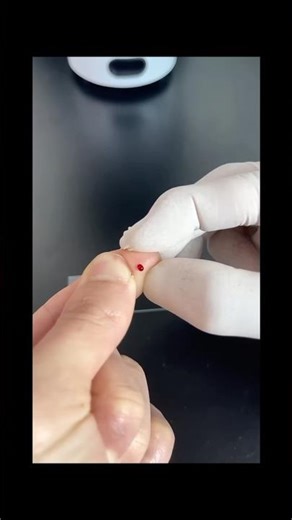 Blood Under the Microscope 🔬 | Microscopic View #microscope #shorts