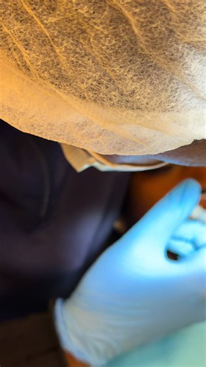 Should I Close My Tooth Gap or Keep It? — Teeth Gap & Whitening Decision