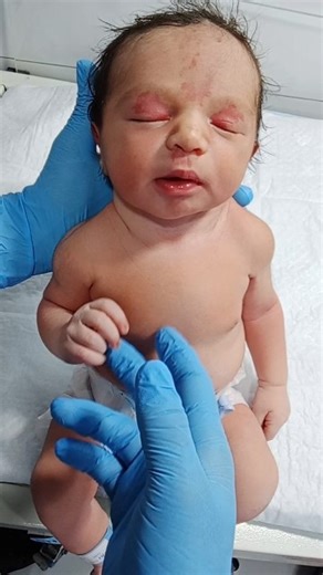 Newborn Baby Checking Rooting Reflex Moment | Feeding Readiness Assessment