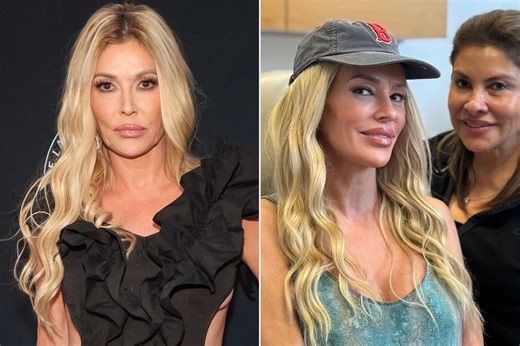 Brandi Glanville debuts new face amid struggle with 'parasite' that disfigured her