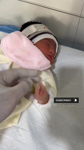 This newborn has ectrodactyly, a rare congenital condition where the fingers or toes develop in a split or claw-like pattern. It happens early in pregnancy when the hand or foot doesn’t form in the typical way. Ectrodactyly can appear on one or both sides and may affect function, movement, or grip, but many children grow up adapting incredibly well. This video shows the baby’s unique fingers and the gentle care given in the NICU while doctors assess mobility and plan the next steps. #ectrodactyl