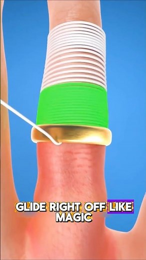 Ring Stuck on Your Finger? Try This Genius Trick!