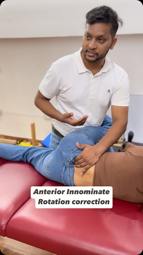 🔆What is Anterior Innominate Rotation:- 💢The anterior superior iliac spine (ASIS) moves forward and down 💢The posterior superior iliac spine (PSIS) moves backward and up 💢The ischial tuberosity moves backward and up It results in lower back pain , also person can feel leg length difference! Here we are doing mobilisation with Muscle energy techniques to correct it ! #backpain #physiotherapy #physiotherapist #chiropractor #chiropractic #chiropractoringurgaon #chiropractornearme #sijoint #sijo