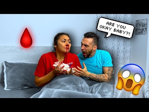 Waking Up With A Bloody Nose Prank On Boyfriend * Scared Reaction *