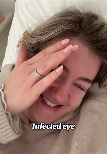 Dealing with Eye Infections: A Mum's Perspective