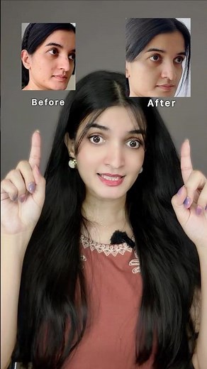 The derma co face wash | Face wash for acne prone skin #acne #pimple #shorts