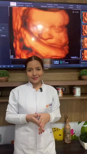 Realiza tu control de embarazo con nosotros. 💕🤰🏻🫶🏻Llevar un control de embarazo te permitirá garantizar un parto seguro y un inicio saludable en la vida de tu bebé. 🤗#controldeembarazo #salud #consulta #ecografia #parati | SuMédico Centro Médico