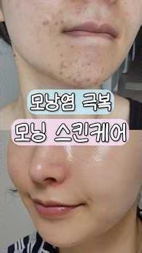 초민감성 피부의 모낭염 극복 스킨케어 루틴(모닝편) #민감성피부 #스킨케어 #모낭염