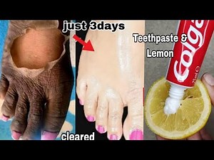 The secrets of lemon and teethpast to eliminate bad odour 🌿🌟 HomeTip