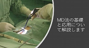 MD（Microdiscectomy）法の基本手技