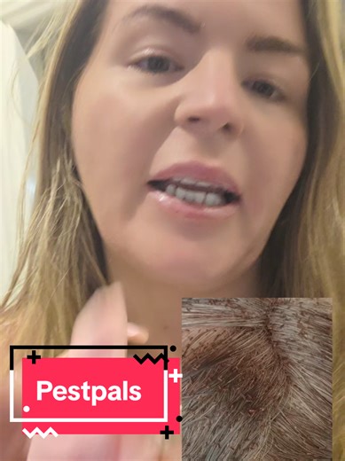 Effective Nits Prevention with Pest Pals Scrunchies