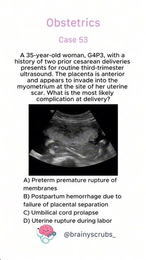 Obstetrics - Case 53