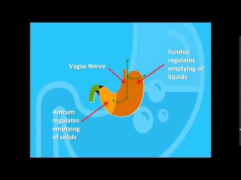 What is Dumping Syndrome?